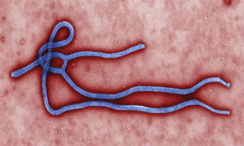 Cuidados con el Ebola