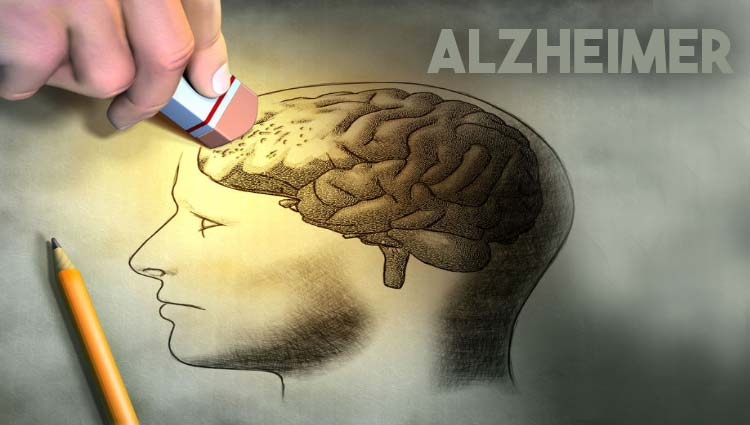 Alzheimer / Aumentan los casos en la República Argentina y el mundo.